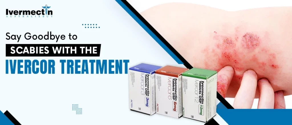 Say Goodbye to Scabies with the Ivercor Treatment