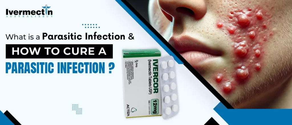 What is a Parasitic Infection and how to cure it?